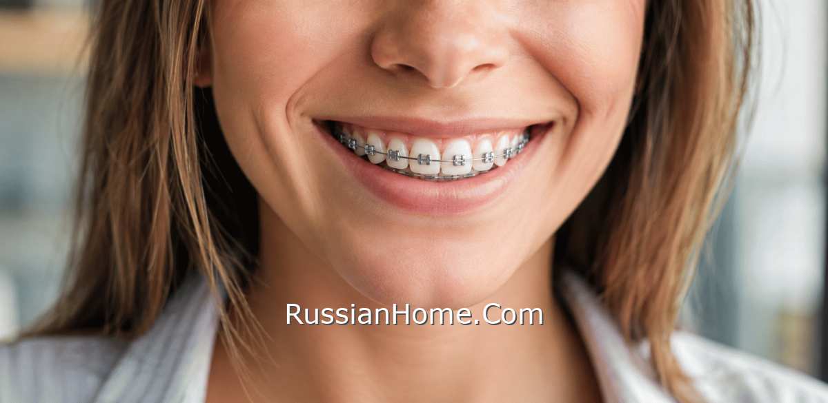 Женская улыбка с брекетами